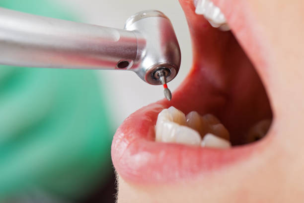 Best Walk-In Emergency Dentist in Center, CO